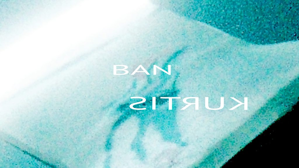 BANKURTIS